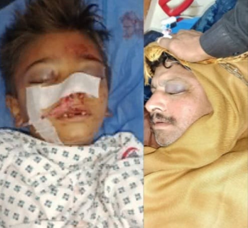 ڏوڪري ڀرسان ڦر دوران جوابدارن هٿان نوجوان زال ۽ معصوم ڌيءَ سميت مرڻينگ