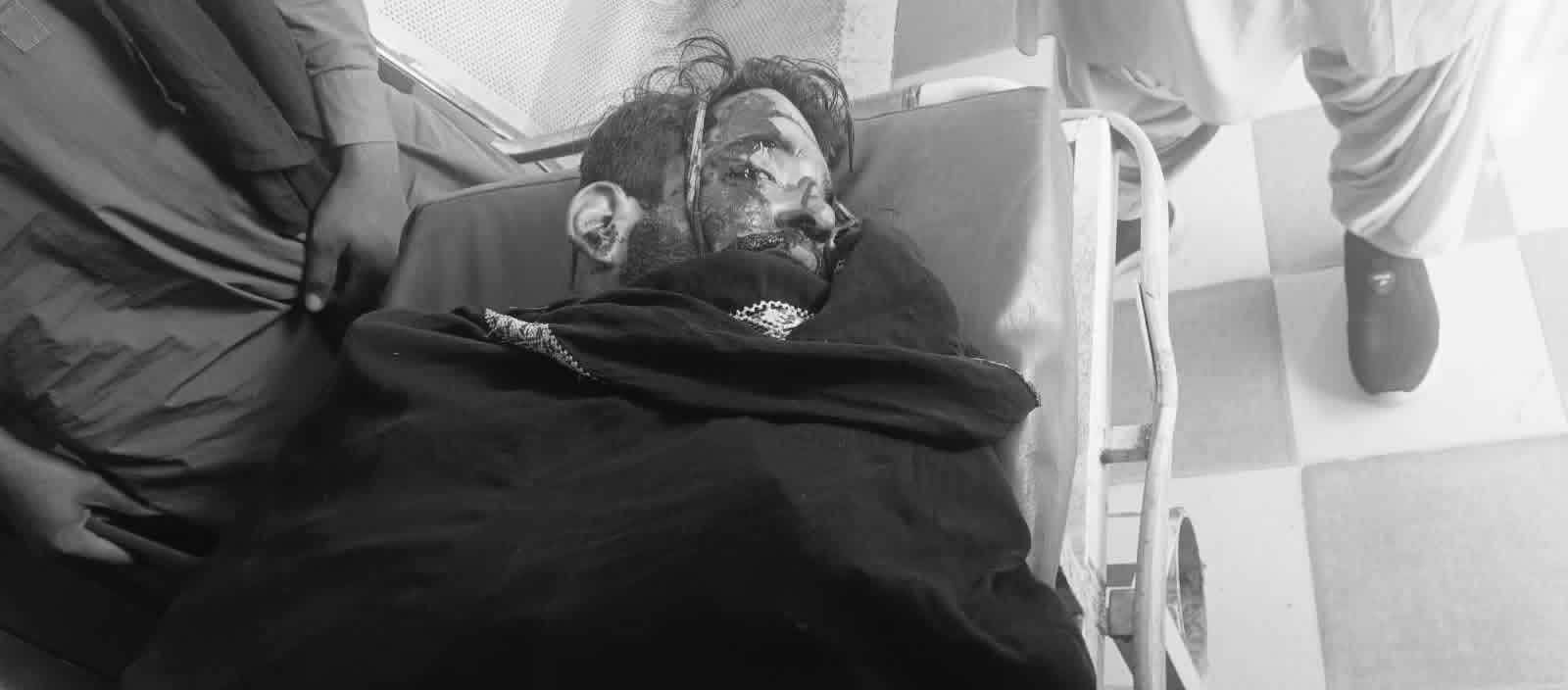 گهارو ويجهو حادثي ۾ هڪ ڄنو فوت، ٻيو زخمي