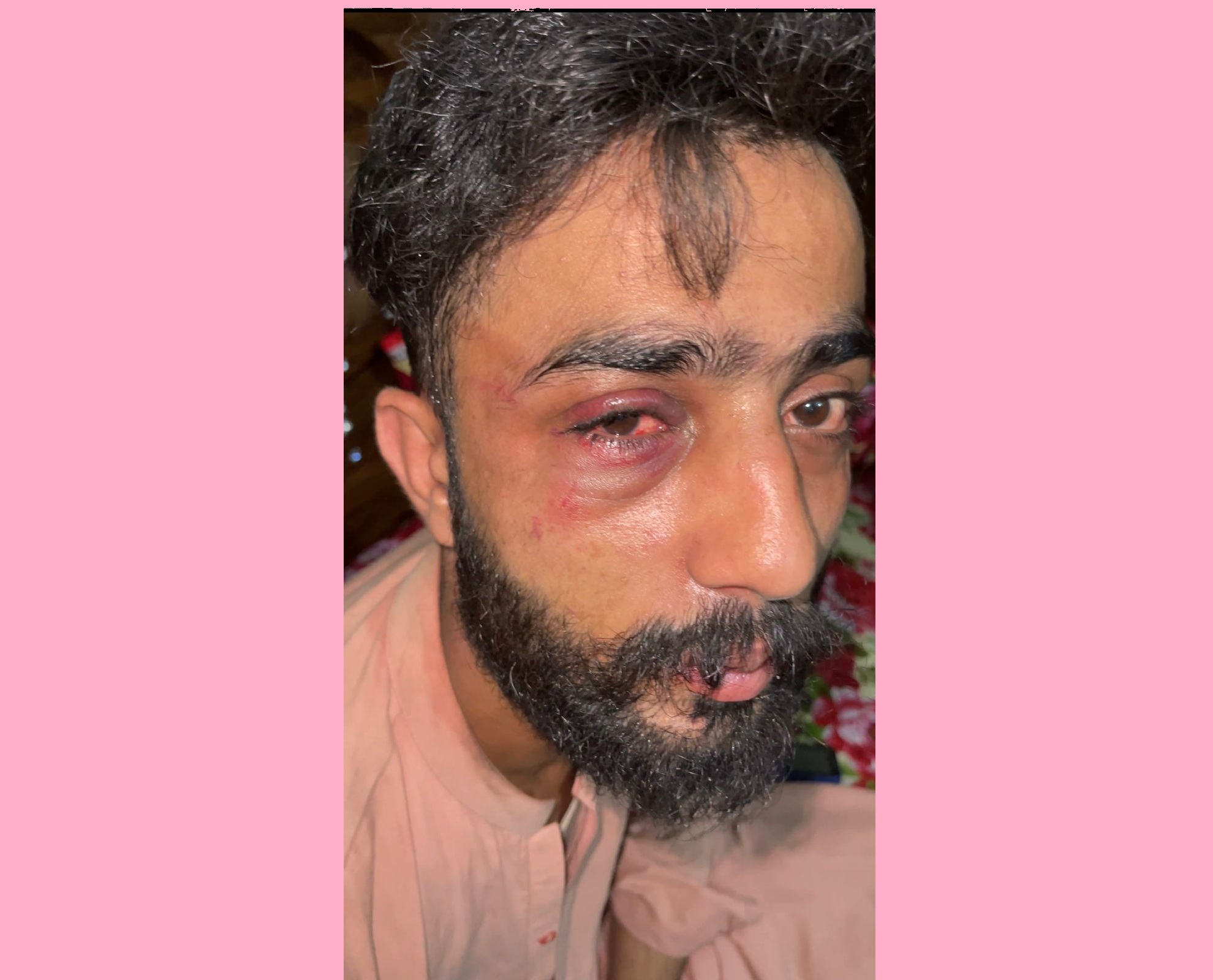 گلشنِ حديد ۾ فوڊ سپلائر رائيڊر تي تشدد، موبائل فون ۽ روڪ رقم مبينا ڦر