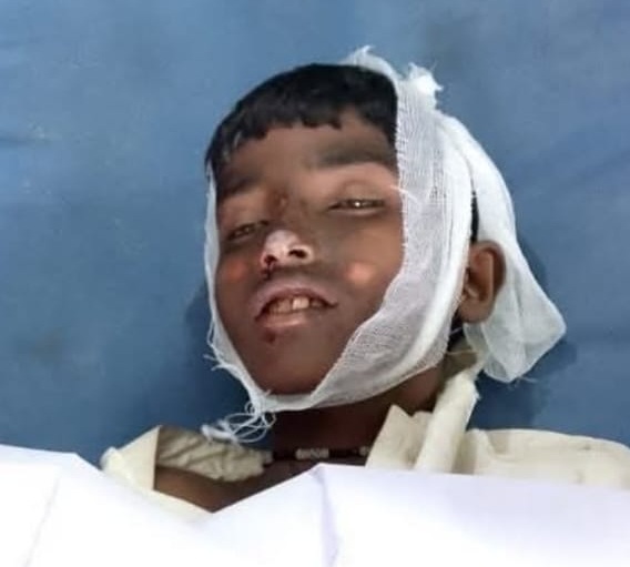 ڌاٻيجي ۾ روڊ پار ڪندڙ نينگر ڪار جي ٽڪر ۾ فوت