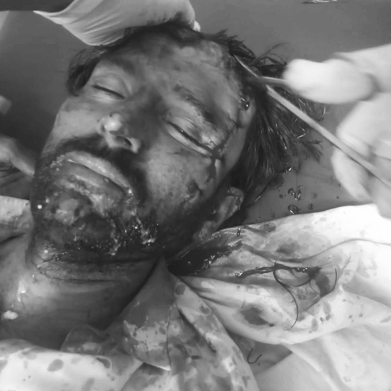 غلام الله ويجهو ٻروسر ڪالوني وٽ جهيڙي دوران هڪ ڄڻو قتلخ