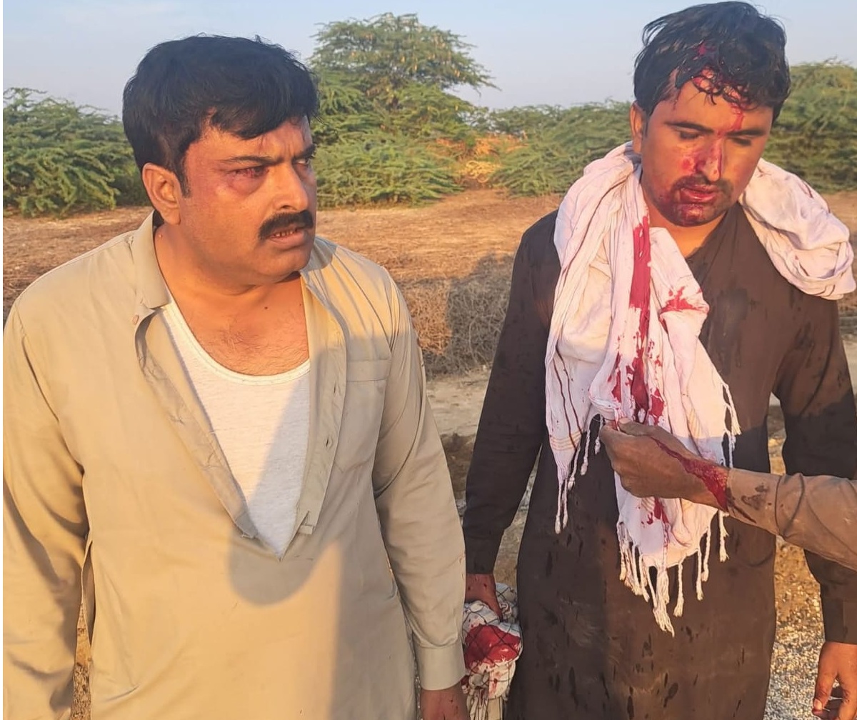 نيو ڇور ٿاڻي جي حد ۾ سماجي اڳواڻ تي مبينا قاتلاڻو حملو، ڀاءُ حيدرآباد ريفر