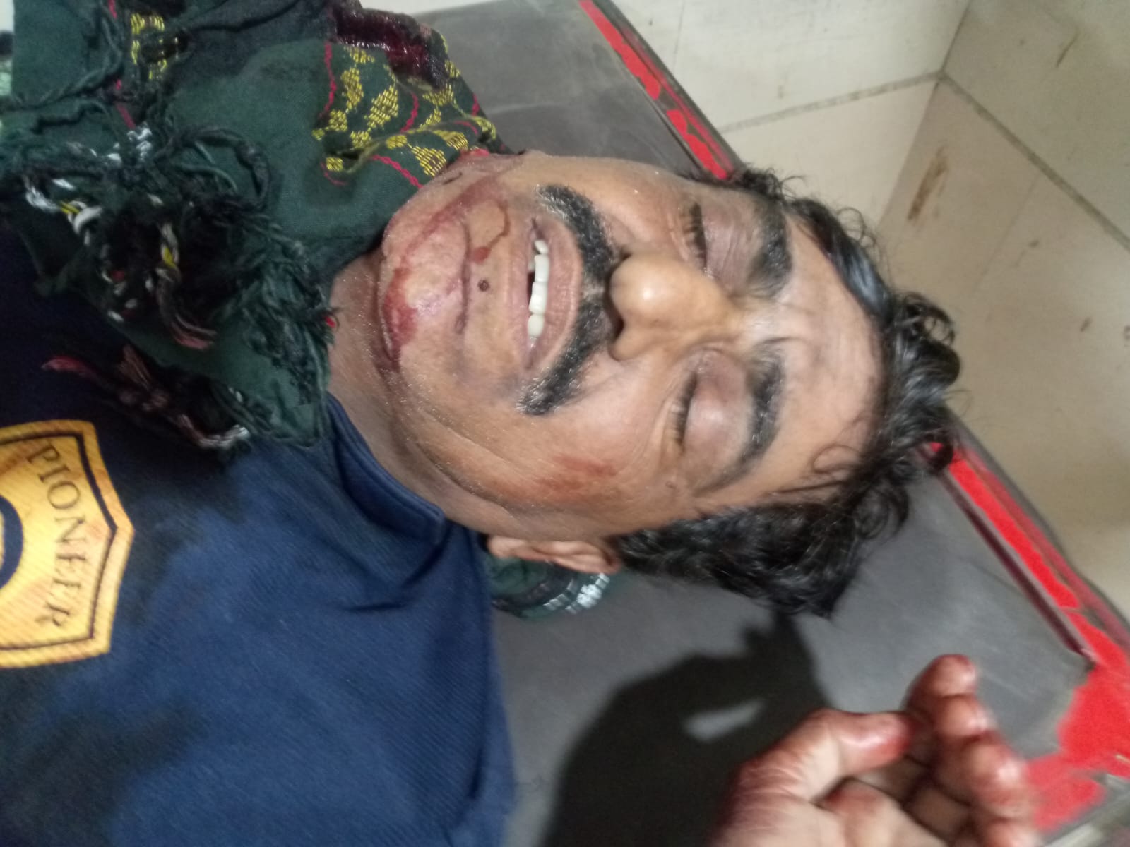 ملير: پورٽ قاسم ٽرڪ پارڪنگ ڀرسان ڦورن جي فائرنگ ۾ سيڪيورٽي گارڊ زخمي