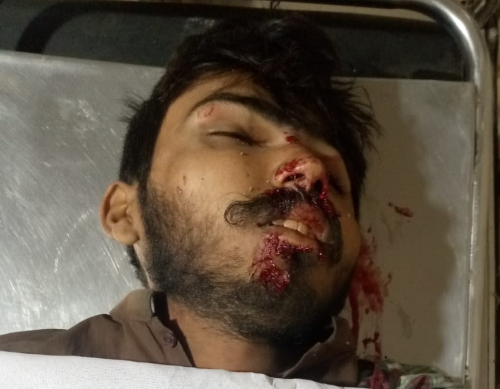 ملير ۾ ٽريفڪ حادثو، لوڊر گاڏي جي ٽڪر سان نوجوان فوت