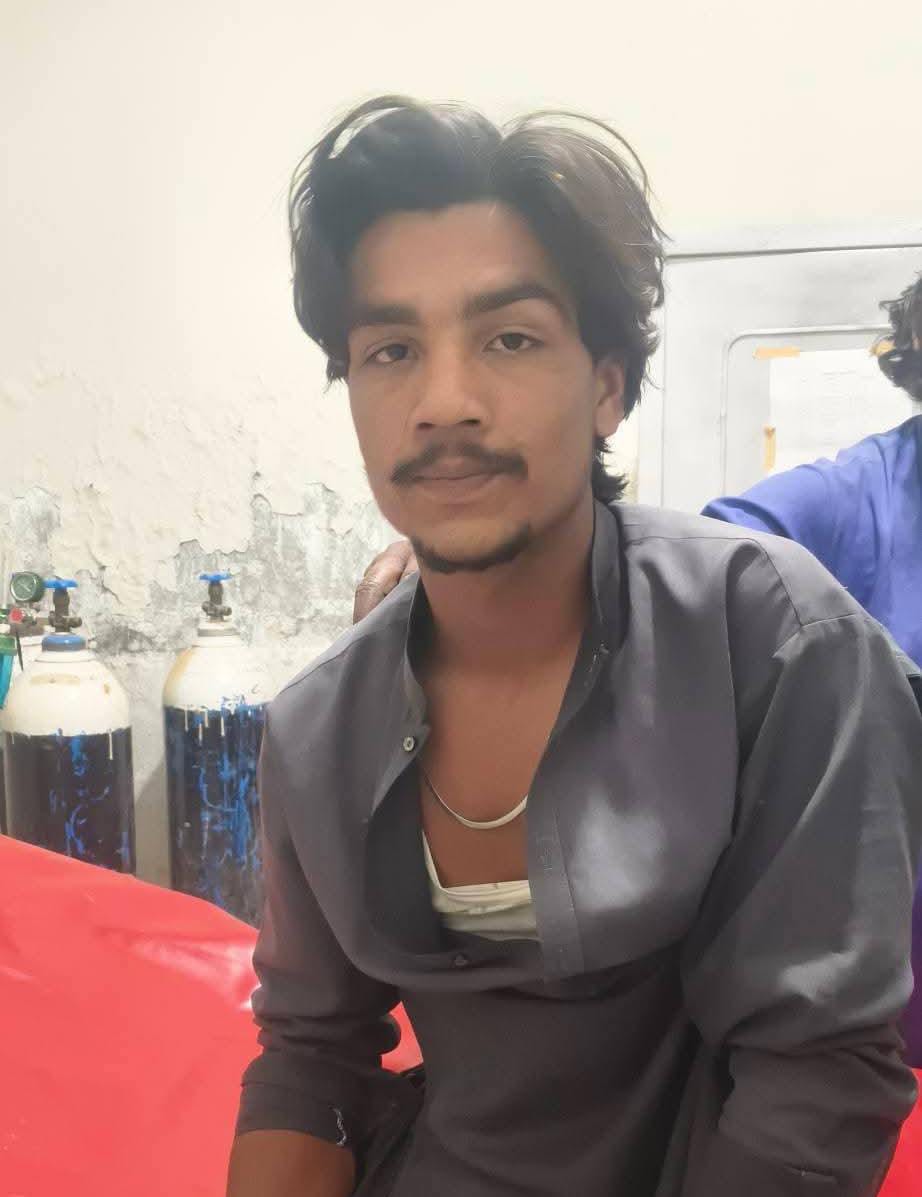 هڱورجا ۾ ڦر دوران مزاحمت تي ڦورن جي فائرنگ ۾ نوجوان زخمي