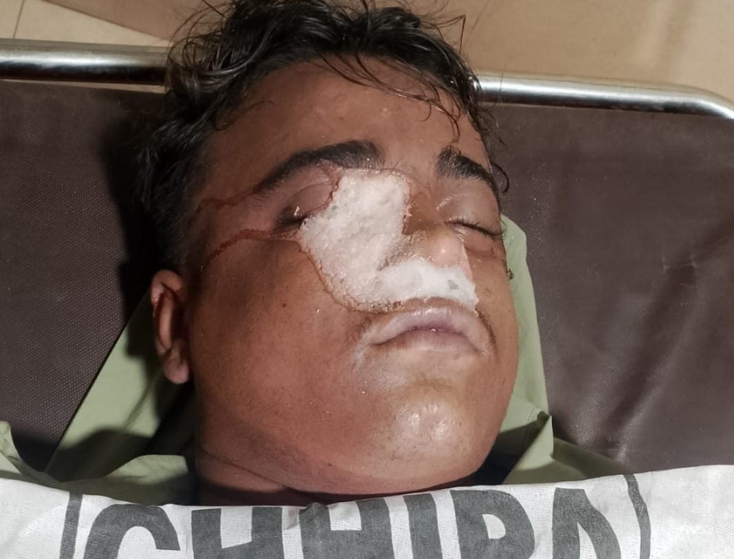 ملير فيڪٽري  زون ويجهو ڪمپني ۾ وڻ ڪرڻ سبب نوجوان فوت، جناح اسپتال منتقل