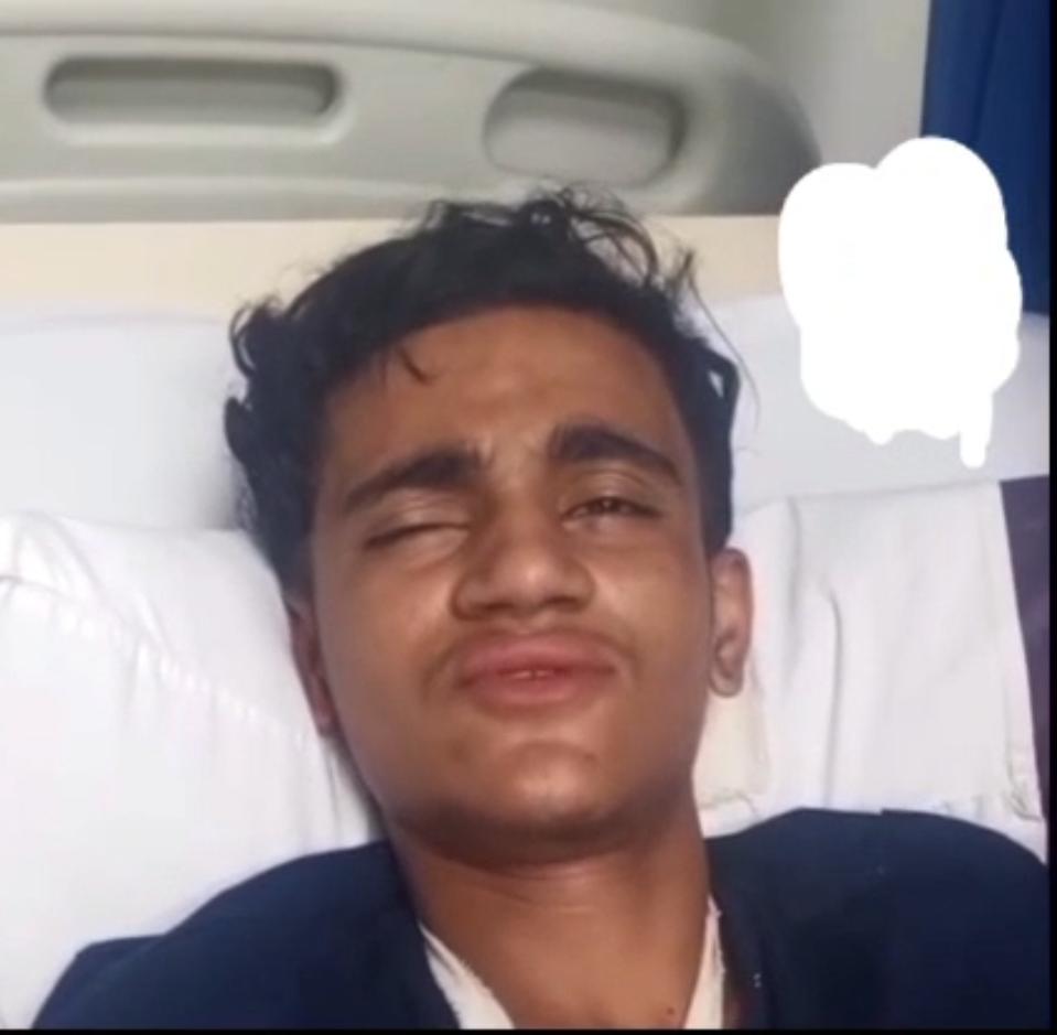 ملير: کوکراپار ڀرسان قلم جهڙي شئي ڦاٽڻ سبب نوجوان زخمي