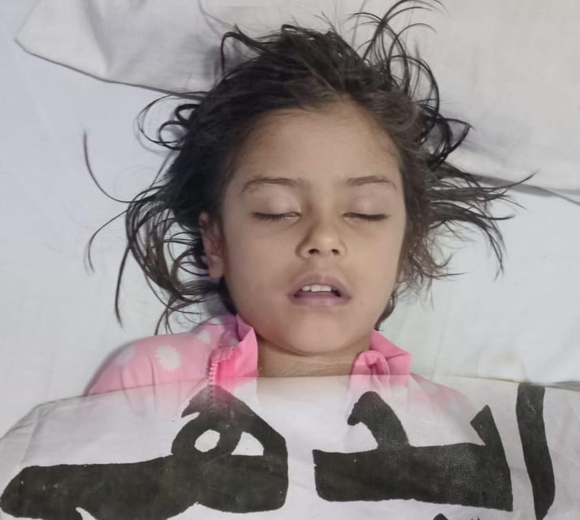 ملير: سپر هاءِ وي ڀرسان سوئمنگ پول ۾ ٻڏڻ سبب 4 ورهين جي نينگري فوت